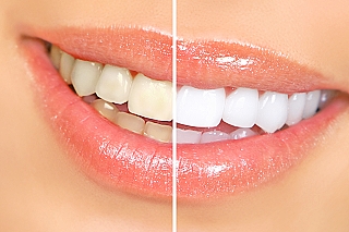 Bleaching