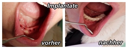 Implantate vorher-nachher